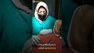 Episiotomy sciessor Part1 doctor delivery hospital nursingexperts pregnancy nursingstudents [upl. by Eelyr100]