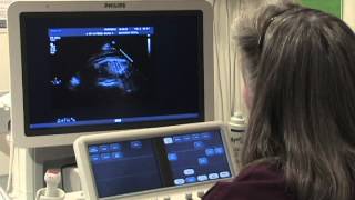 What Is a Fetal Echochardiogram Test [upl. by Lubeck]