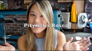 Skin Journey Part 1  My Experience with Pityriasis Rosea [upl. by Ventura]