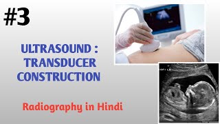 ULTRASOUND  TRANSDUCER CONSTRUCTION [upl. by Yumuk328]