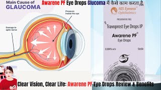 STOP Wasting Money on Ineffective Eye Drops Try AWARENEPF Instead [upl. by Helms258]