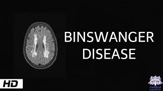 Binswanger disease Causes  Signs and Symptoms Diagnosis and Treatment [upl. by Auqinot]