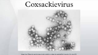 Coxsackievirus [upl. by Statis]