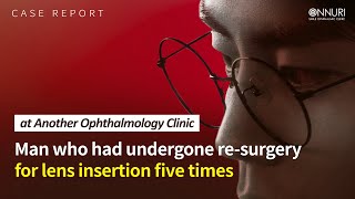 Case of Successfully Operating on a man Previously Deemed Inoperable at Another Ophthalmology Clinic [upl. by Kampmann602]