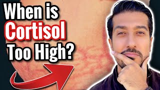 5 Signs of High Cortisol to NOT IGNORE  What Lowers Cortisol [upl. by Trudnak]