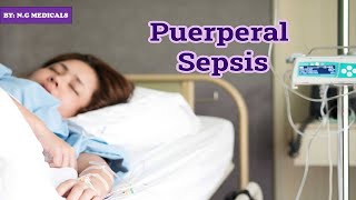 puerperal sepsis part 1 NGMedicals [upl. by Padegs]