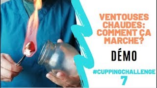 Les ventouses chaudes  Mode demploi DÉMO Cupping therapyHijama [upl. by Avelin]