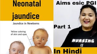 part 1 Neonatal jaundice icterus neonatorum neonatal hyperbilirubinemia  types Hindi [upl. by Piero178]