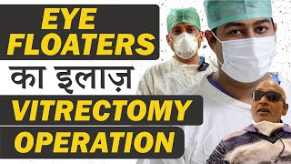 Eye Floaters Treatment by Vitrectomy Surgery  Near LIVE Surgery  Best Retinal Treatment at Eye7 [upl. by Centonze]