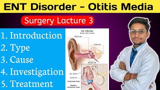 Otitis Media  Ear Disorder  ENT Disorder  Surgery Lacture in Hindi  Easy Notes [upl. by Tenner]