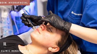 Hydrafacial  les différentes étapes du soin  Clinic Renaissance  médecine esthétique [upl. by Magnus]