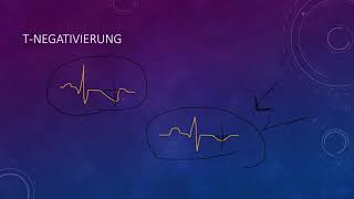 EKG befunden leicht gemacht Teil 4 [upl. by Claudie497]