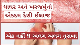 ધાધર ખરજવું નો દેશી ઈલાજ । dhadhar no ilaj gujarati । skin disease home remedy [upl. by Ymar137]