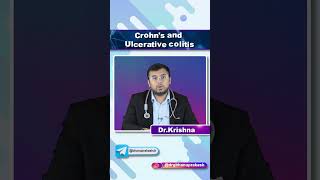 Crohns Disease vs Ulcerative Colitis  Quick Bites Internal Medicine Gastroenterology [upl. by Yma]