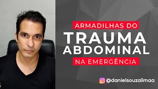 Armadilhas do Trauma Abdominal na Emergência [upl. by Leahcimrej]