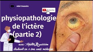 Physiopathologie de lictère  PARTIE 2  Ictère a bilirubine non conjugué [upl. by Jonna]