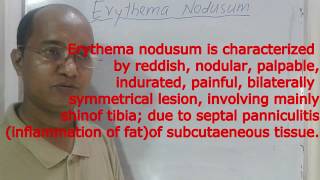 Erythema nodosum  panniculitis Definition Cause Pathology Clinical featureTreatment [upl. by Ahsrav16]