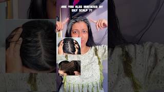 Tips for Oily Irritated Scalp  Itchy Oily Scalp haircare [upl. by Aitak]