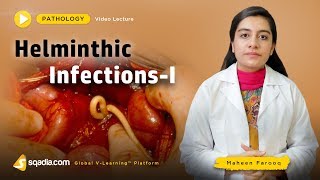 Helminthic Infections  Pathology Course  Medical Education  VLearning  sqadiacom [upl. by Elberfeld]