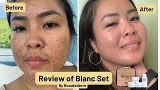 Blanc Set by Beautederm Product Review  Mrs Dee Beauty VLOGS [upl. by Stevena]