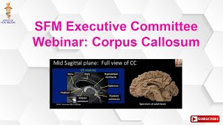 SFM Executive Committee Webinar Corpus Callosum [upl. by Aiuqcaj455]