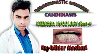 Candidiasis Opportunistic Mycoses [upl. by Nedyarb]