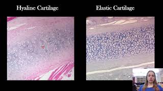 The 4 Most Commonly Confused Tissue Types [upl. by Einuj]