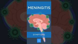 Meningitis Symptoms  Kenhub meningitis [upl. by Icyak]