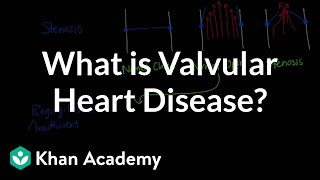 What is valvular heart disease  Circulatory System and Disease  NCLEXRN  Khan Academy [upl. by Olav]