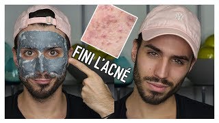 COMMENT JE COMBATS MON ACNE ET JE MATIFIE MA PEAU  SKINCARE ROUTINE  Jordan MKP [upl. by Notlef]