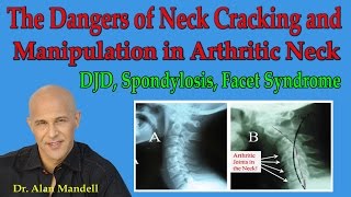 Dangers of Neck Cracking and Manipulation in Arthritic Neck Spondylosis DJD  Dr Mandell [upl. by Hester]