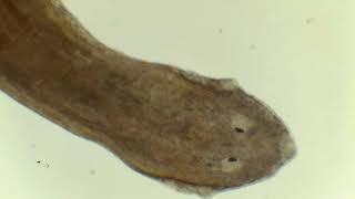 Planaria Under Microscope [upl. by Deerc]