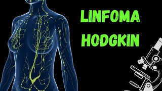 Linfoma Hodgkin [upl. by Horton423]