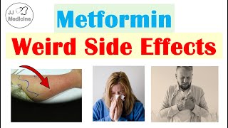 Metformin Weird Side Effects amp Why They Occur [upl. by Wallache69]