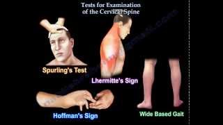 Tests For Examination Of The Cervical Spine  Everything You Need To Know  Dr Nabil Ebraheim [upl. by Kesley]