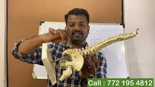 कमरेतील मणका सरकने  सायटीका  L4 over L5 amp L5 over S1 Spondylolisthesis  sciatica [upl. by Gurango150]