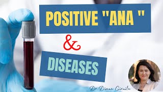 Positive ANA test antinuclear antibodies and autoimmune diseases [upl. by Heyward]