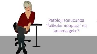 Patoloji sonucunda ‘foliküler neoplazi’ ne anlama gelir [upl. by Inigo]