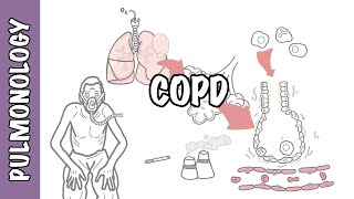 Understanding COPD  Chronic obstructive pulmonary disease cause pathophysiology and treatment [upl. by Rebmyt]