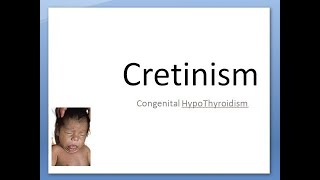 Pediatrics 135 Cretinism Congenital HypoThyroidism Child Umbilical Hernia Tongue Jaundice LOW ALP [upl. by Arbe586]