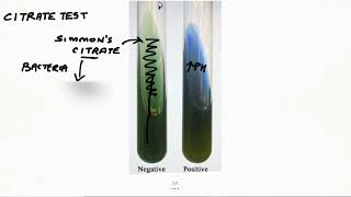 Citrate Test 2 Minutes Microbiology Laboratory Methods Tutorials For NEETPG NEXT USMLE PLAB [upl. by Drusie]