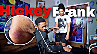 HICKEY PRANK ON GIRLFRIEND Must Watch [upl. by Laure132]