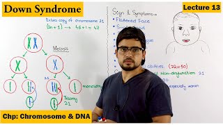 Downs Syndrome  A Genetic Disorder  Lecture 13 [upl. by Tijnar424]