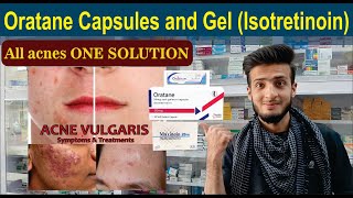 Oratane Capsules  Oratane Gel Isotretinoin  Uses Side Effects Dose Safty  O Beauty Dose [upl. by Erual511]