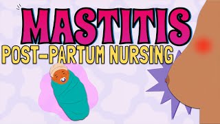 MASTITIS Maternal Newborn Nursing [upl. by Eittak]