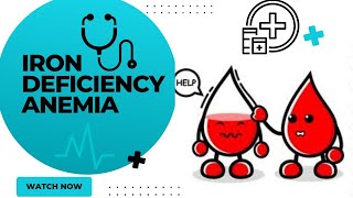 Iron deficiency anemiairon deficiency anemia treatmentanemia notesiron deficiency anemia symptoms [upl. by Dar]