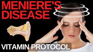 Menieres Disease Reverse Symptoms with These Vitamins [upl. by Llenram401]