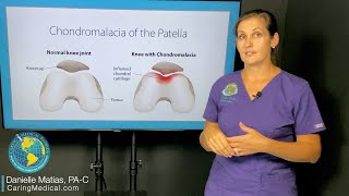 Can chondromalacia patella be treated with Prolotherapy FAQ about knee degeneration and arthritis [upl. by Sihon100]