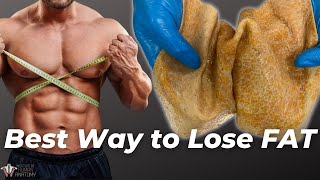 quotLoose Skin After Weight Loss SurgeryquotReal Talk With Dr V [upl. by Akcirederf]