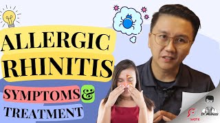 Allergic Rhinitis Symptoms and Treatment Explained [upl. by Eversole]